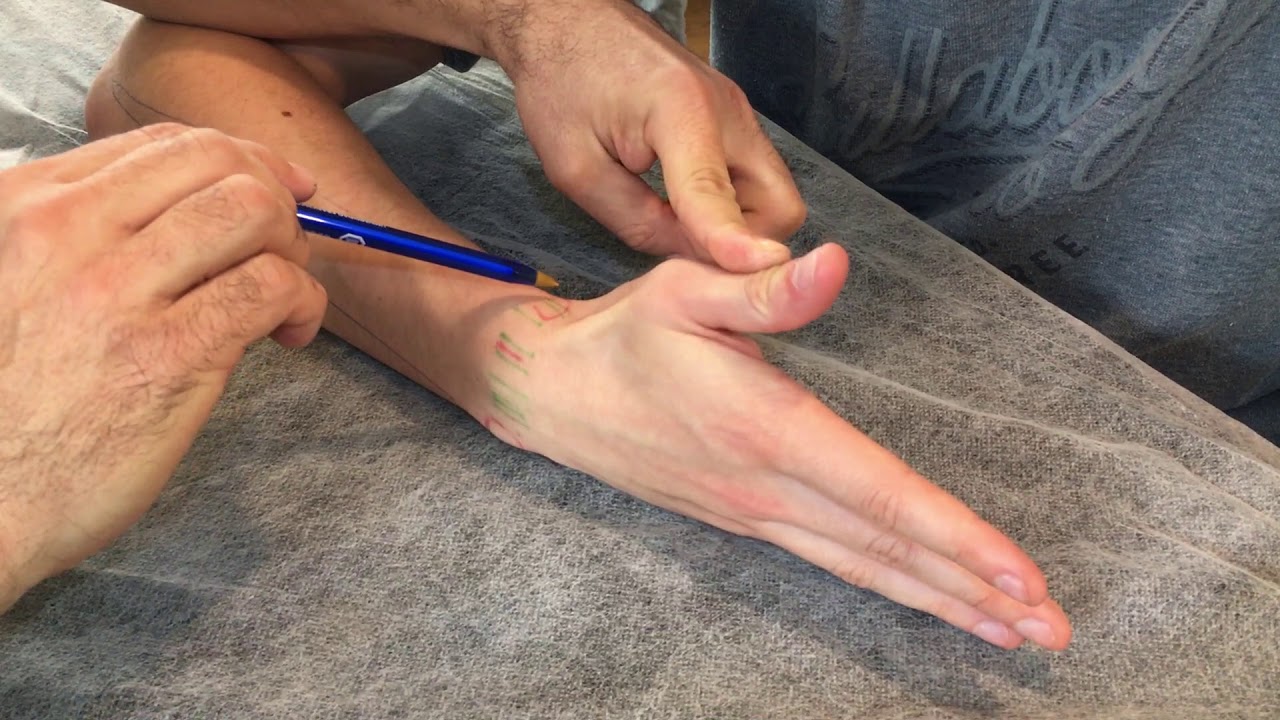 Palpación partes blandas antebrazo 2