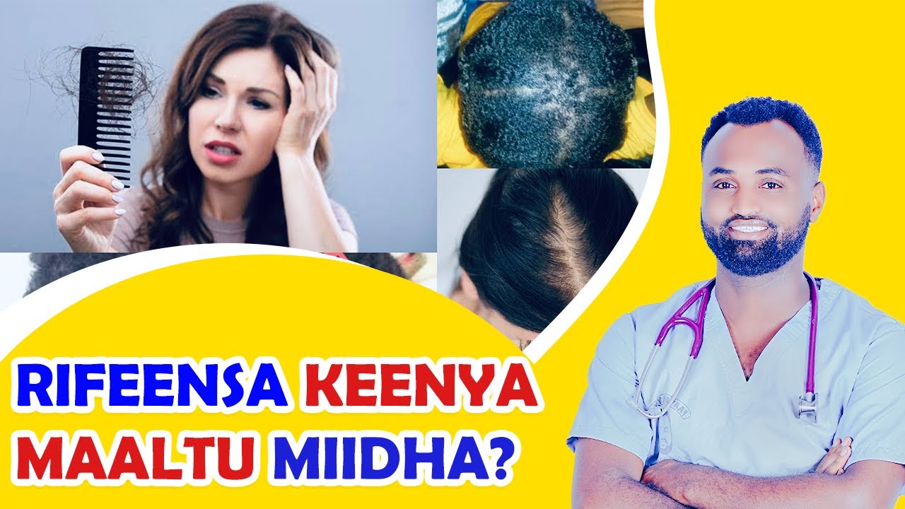 Wantoota 12 Rifeensa keenya caccabsan, haphisan, harcaasaniif fixaniifi furmaata isaa
