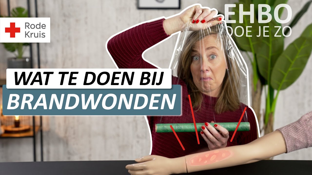 Wat moet je doen bij een brandwond? | Rode Kruis EHBO