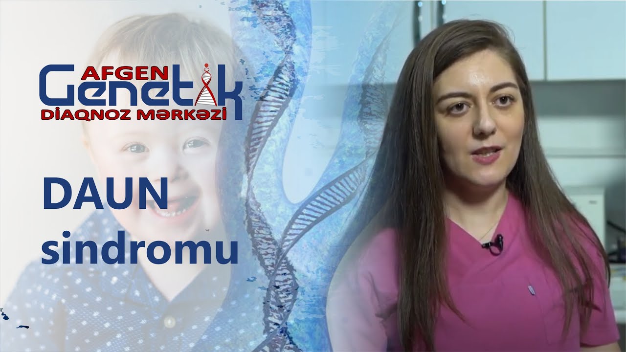 Daun sindromu nədir? Daun sindromuna görə profilaktik müayinənin (skrininqin) növləri.