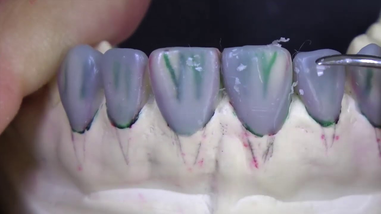 Enceramento 13 ao 23    3 parte Sekito 2019