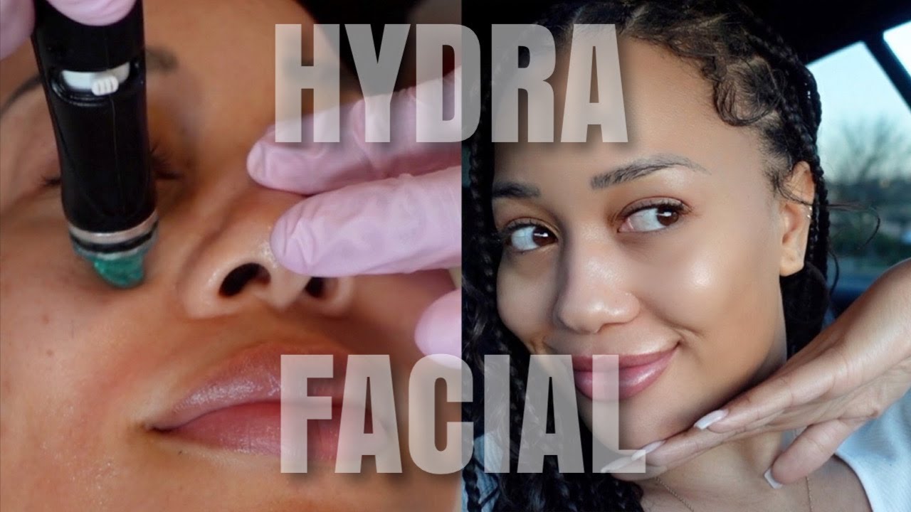 I Tried a Deluxe HYDRAFACIAL! Everything You Need to Know Revealed | Glowing Skin!