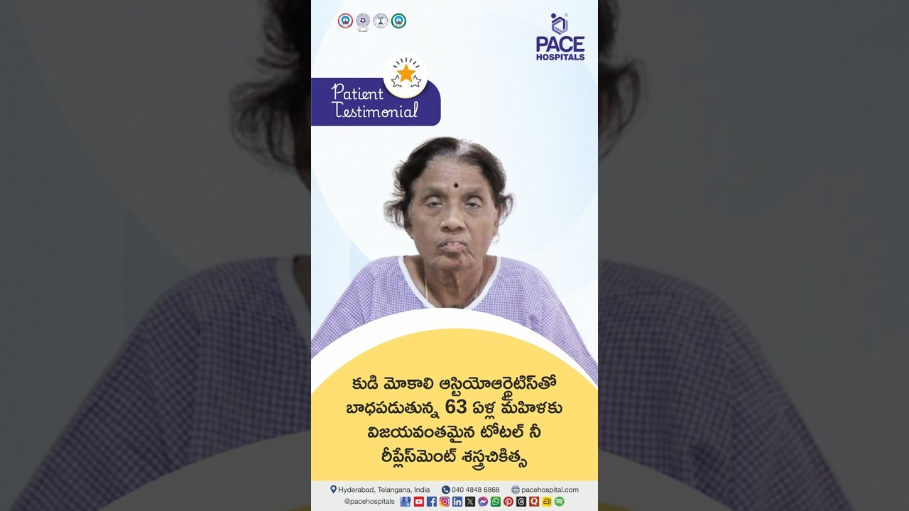 Patient Review - Right Knee Osteoarthritis తో బాధపడుతున్న మహిళకు విజయవంతమైన Total Knee Replacement
