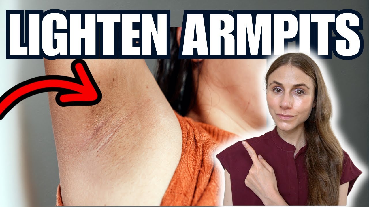 How to Lighten Dark Armpits FAST &ndash; Dermatologist Tips That Actually Work!