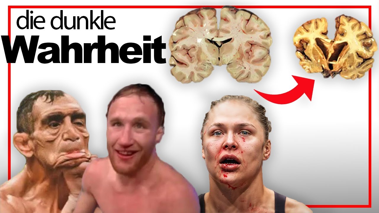 Gehirnsch&auml;den (CTE) im Kampfsport: Wor&uuml;ber keiner spricht