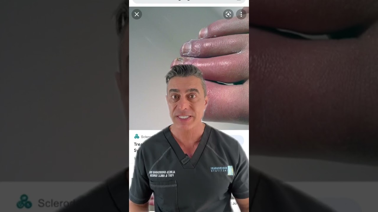 Scleroderma: What is it?