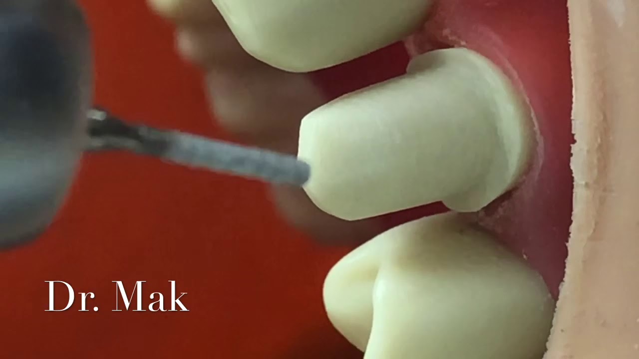 Клинический совет по заданию CROWN PREP