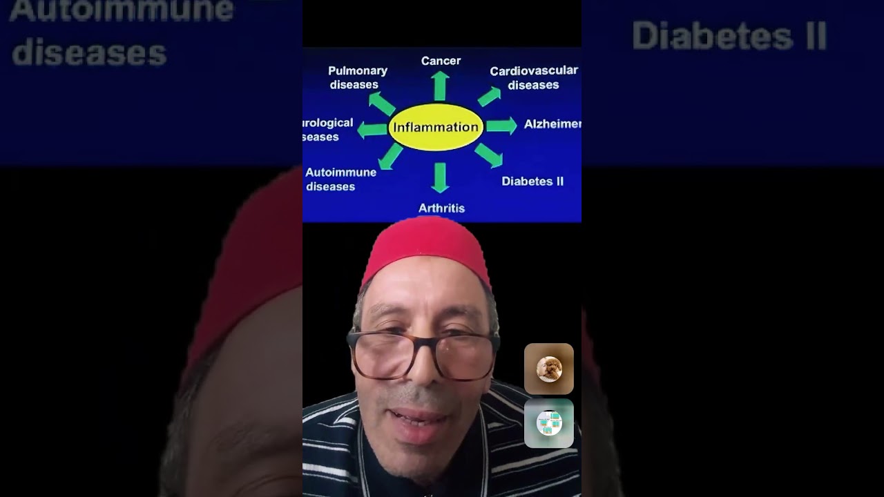 حواري الشيق مع استاذ جامعي في بلد خليجي حول الاسباب الحقيقية للامراض المناعية الذاتية.