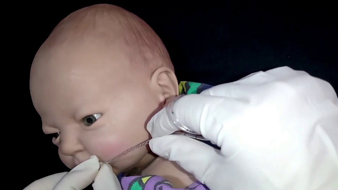 INSTALACIÓN DE SONDA NASOGÁSTRICA Y OROGÁSTRICA EN EL PACIENTE PEDIÁTRICO