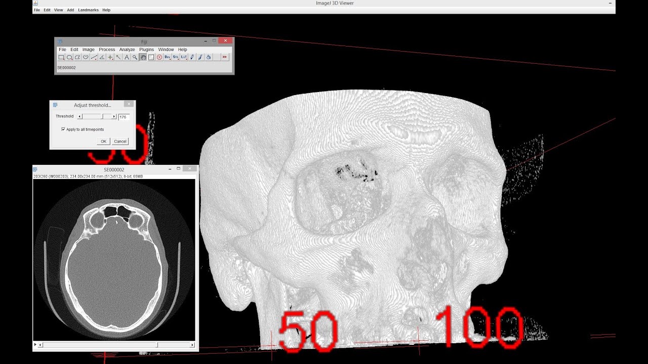 3D viewing of CT / MRT data using Fiji / ImageJ