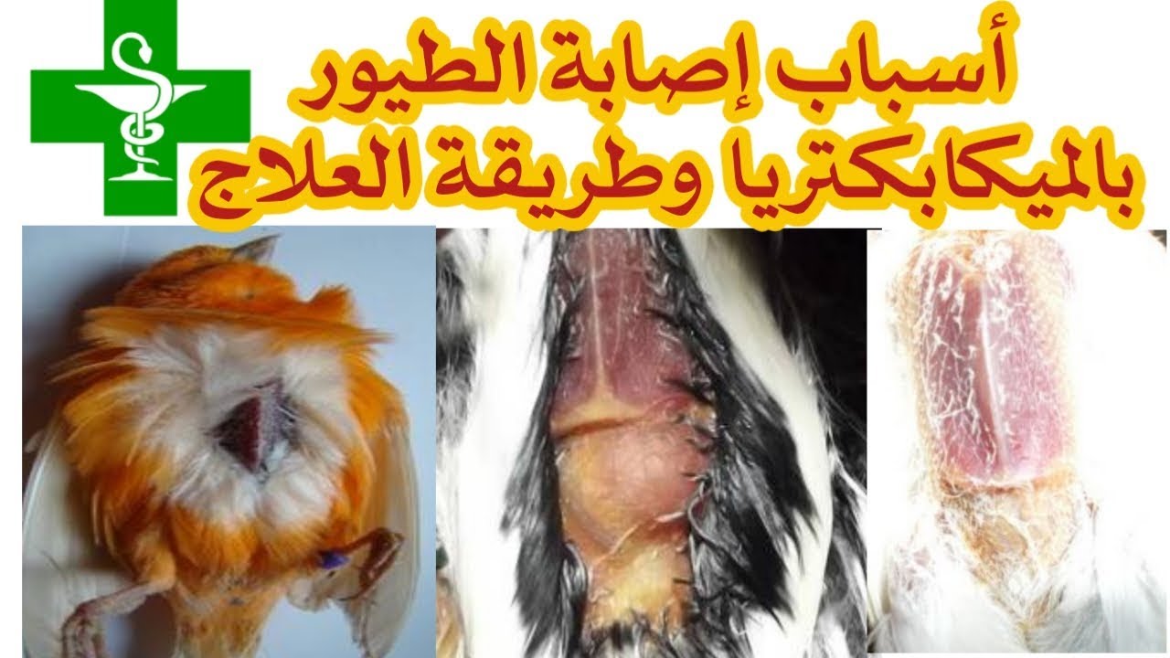 التعريف بالميكابكتريا مسبباتها وطريقة العلاج megabacteria