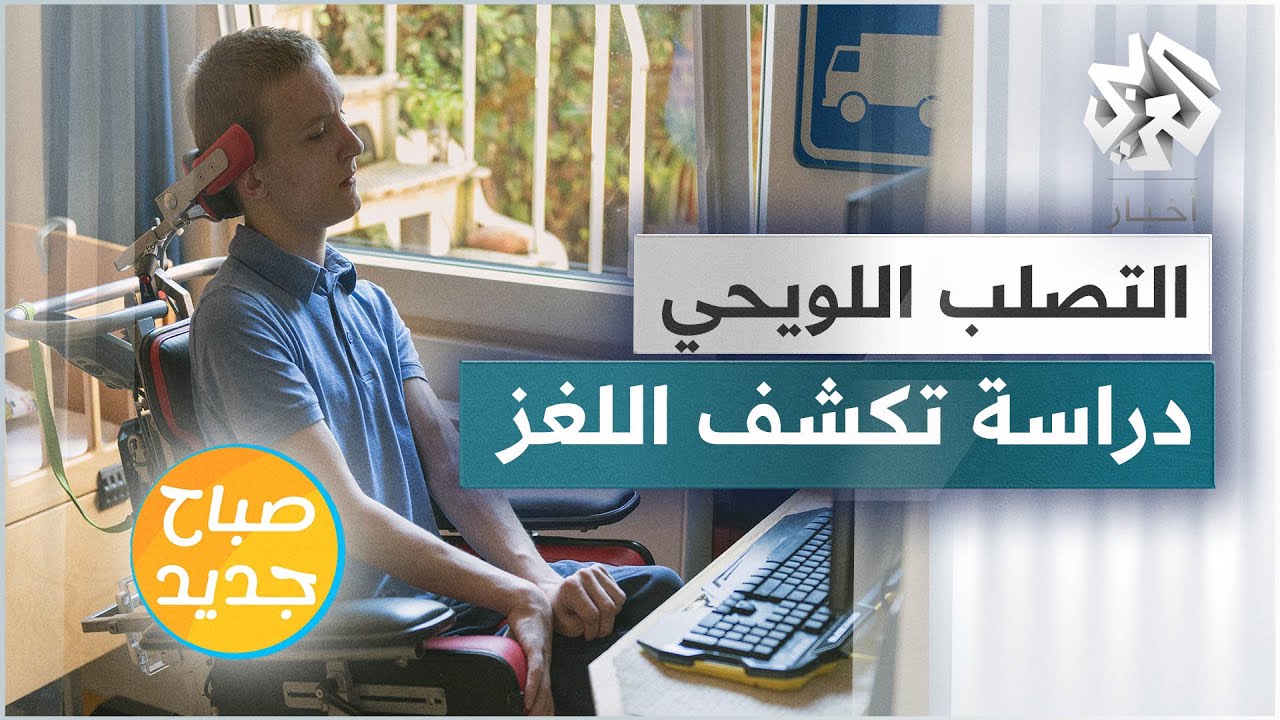 دراسة حديثة تكشف أن مرض التصلب اللويحي سببه فيروس