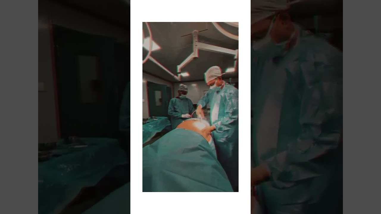 Expert Explains 360 Liposuction | Sculpt Aesthetics | 360 Liposuction Results #360liposuction