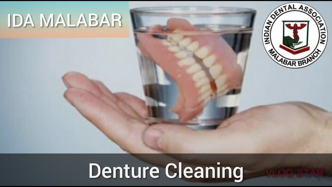 Denture Cleaning - വെപ്പ്  പല്ലുകൾ വൃത്തിയാക്കുന്ന രീതി  by WDC IDA Malabar 2020
