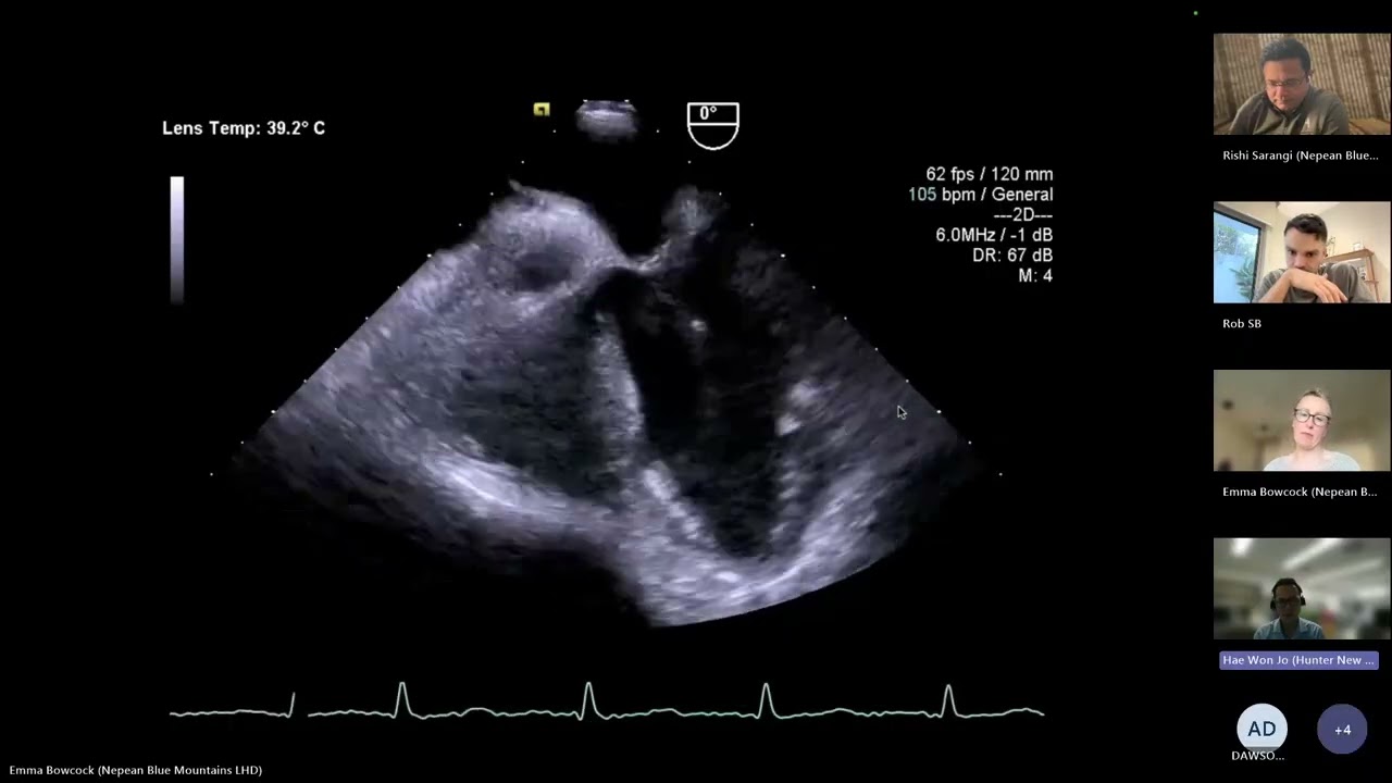 Critical care echo cases