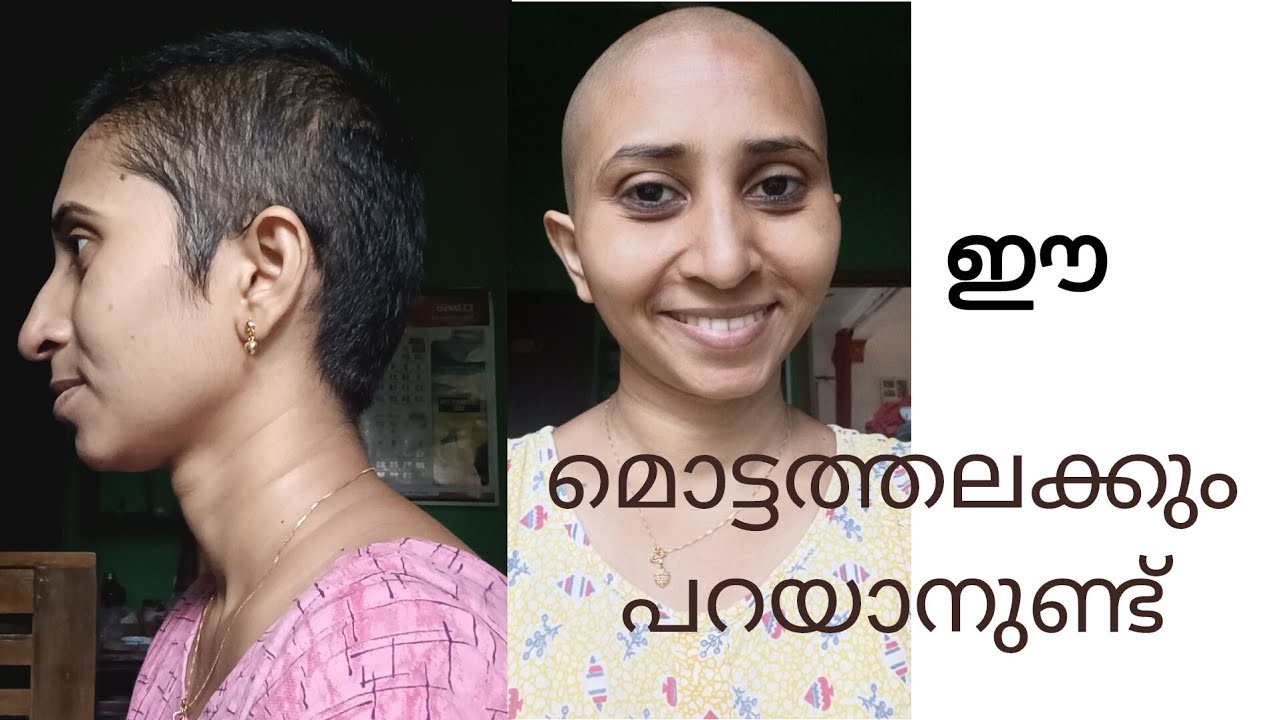 മൊട്ട തലയുടെ അനുഭവം #gayathriathira #trendingvideo #baldhair #baldhead #hairdonation