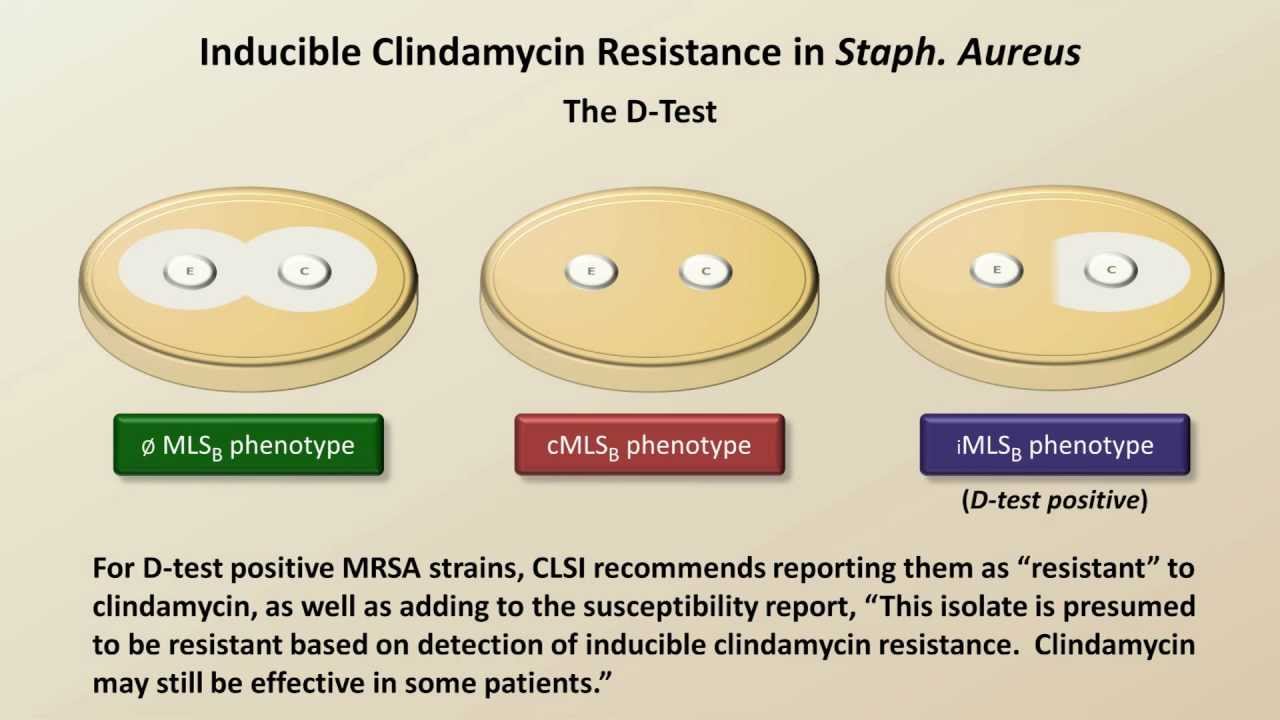 Antibiotic Resistance (Antibiotics - Lecture 9)
