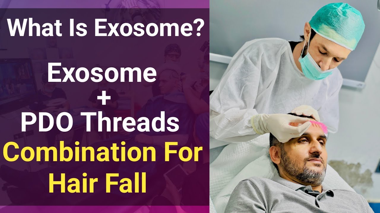 What Is Exosome? || Exosome + PDO Threads For Hair Fall