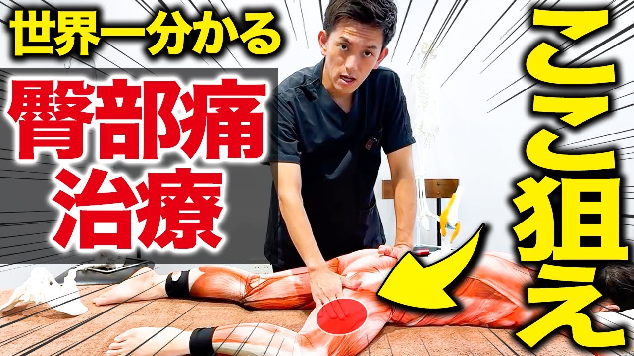 【9割の治療家が理解できていない】この筋肉を診れば分かる！臀部治療の触診術と治療テクニックを大公開！！