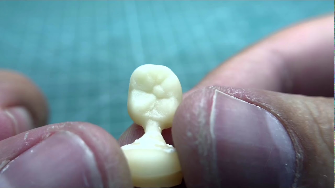 Изготовление коронки из циркония и пресс керамики | Making crowns from zirconium & pressed ceramics