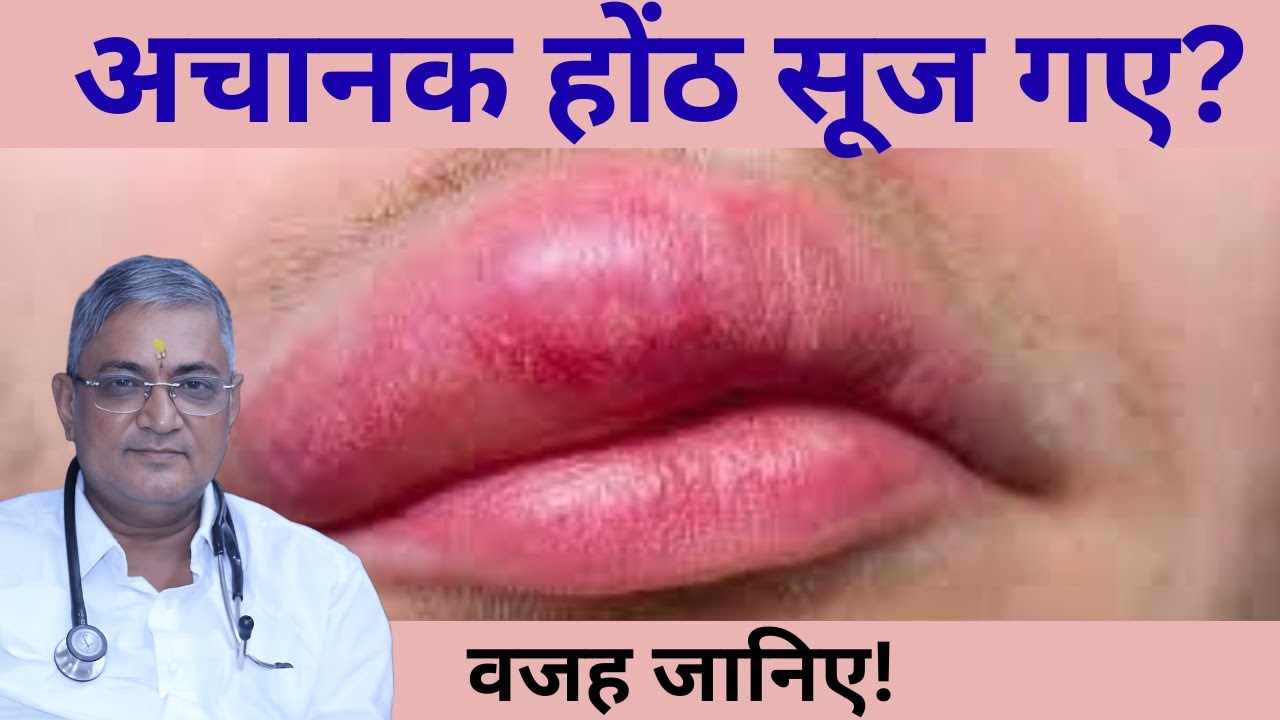 होठों में सूजन? जानिए असली वजह और इलाज!
