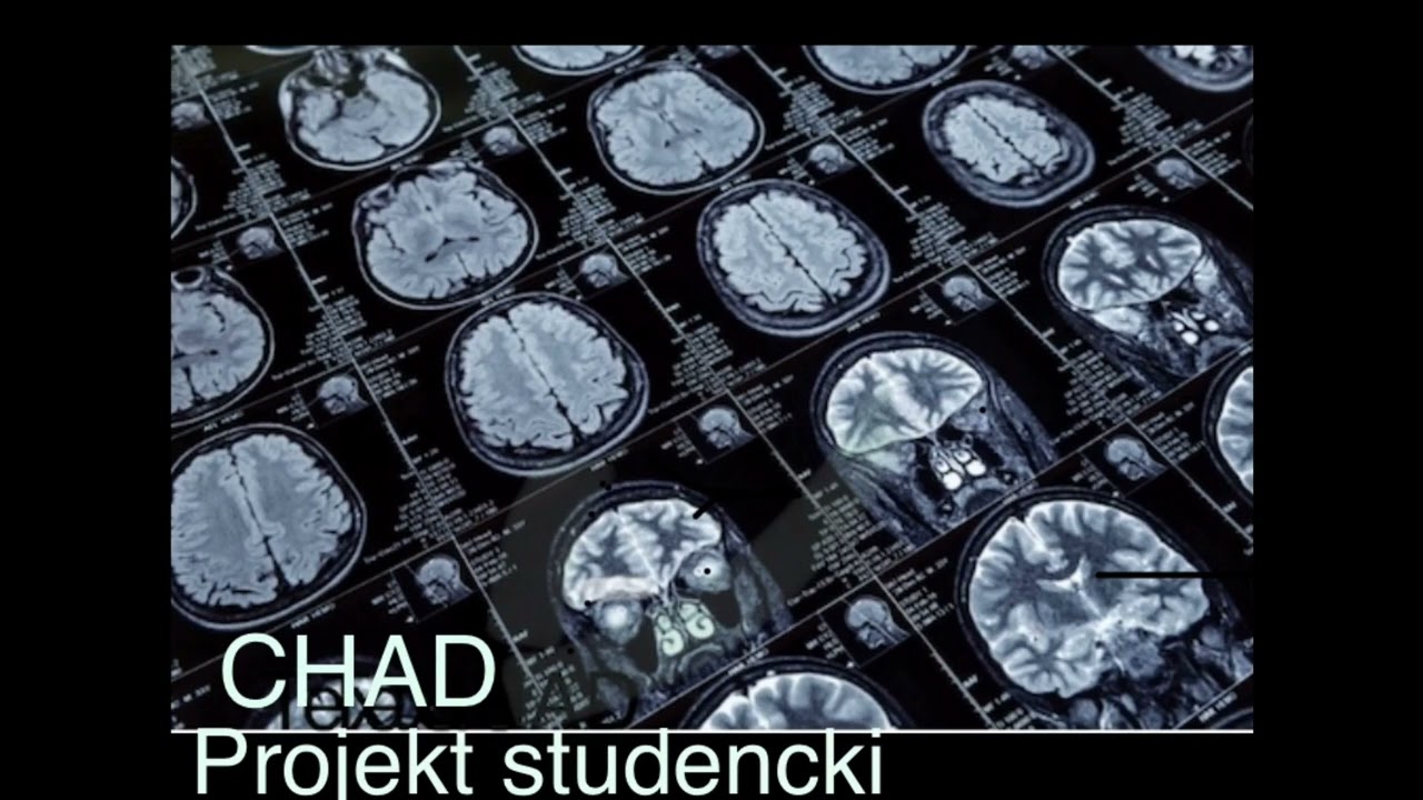 Projekt studencki - Bipolar - ADHD - Psychopatia