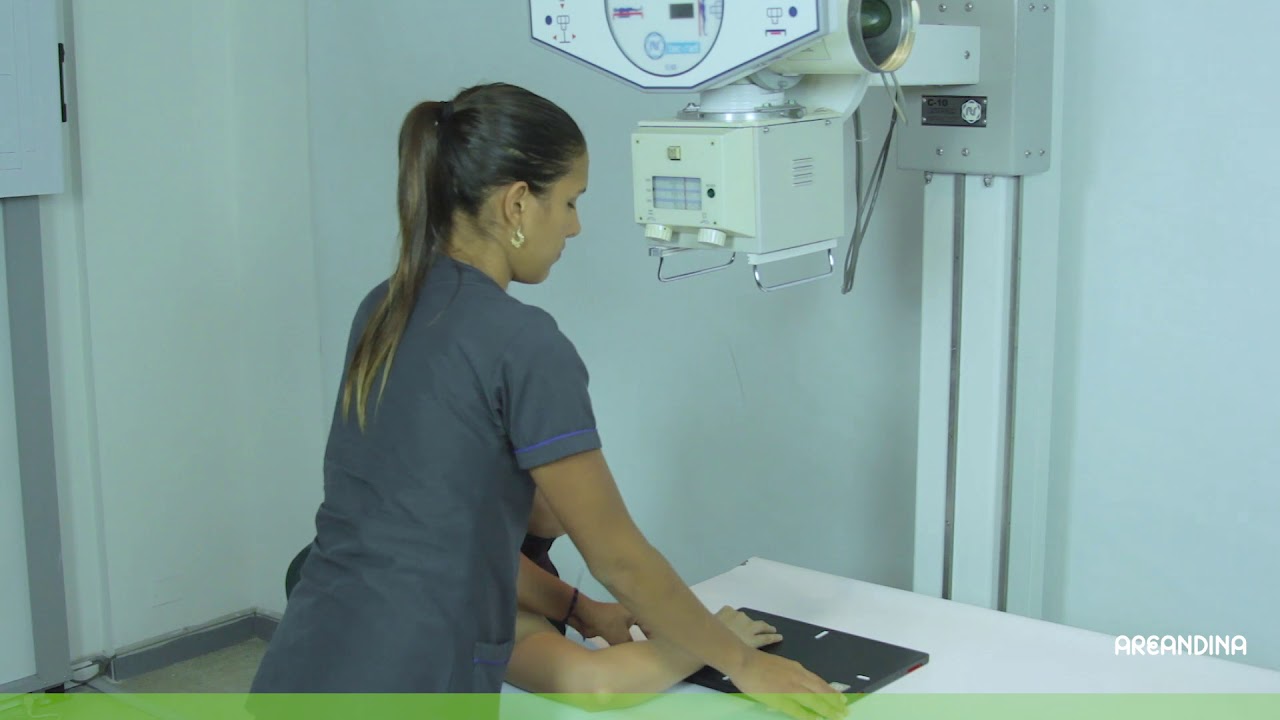 18 19 20 RADIOGRAFÍA DE MANO    PA, OBLICUA, LATERAL