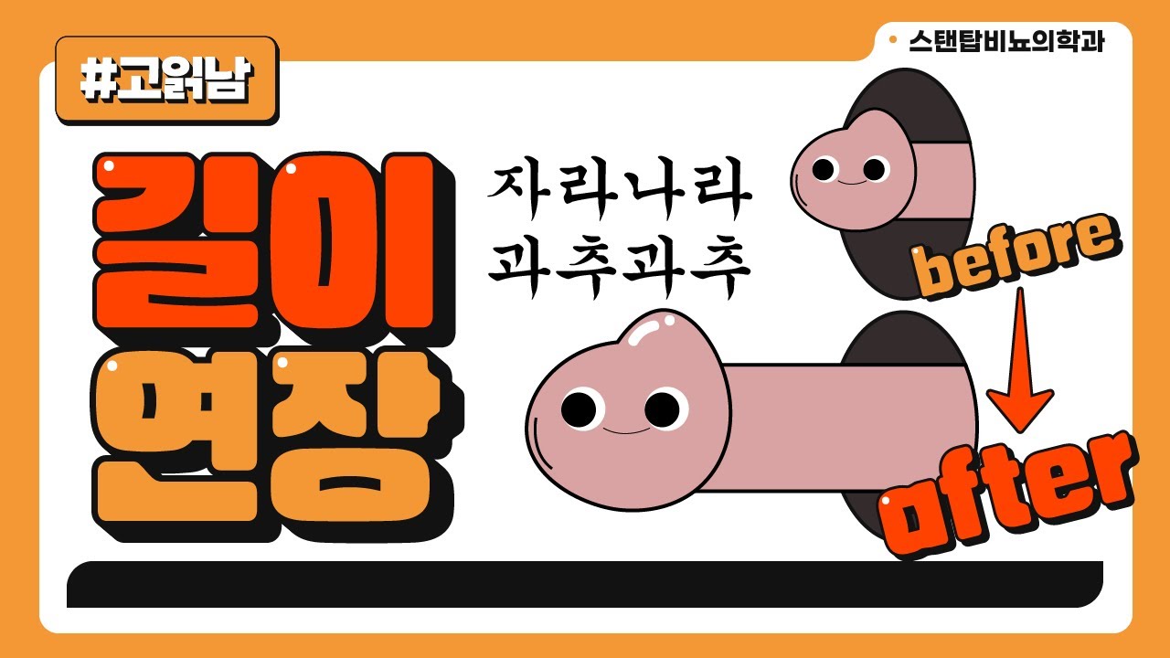 과추 길이연장이 가능하다고요? 함몰음경인 사람 여기여기 붙어라!