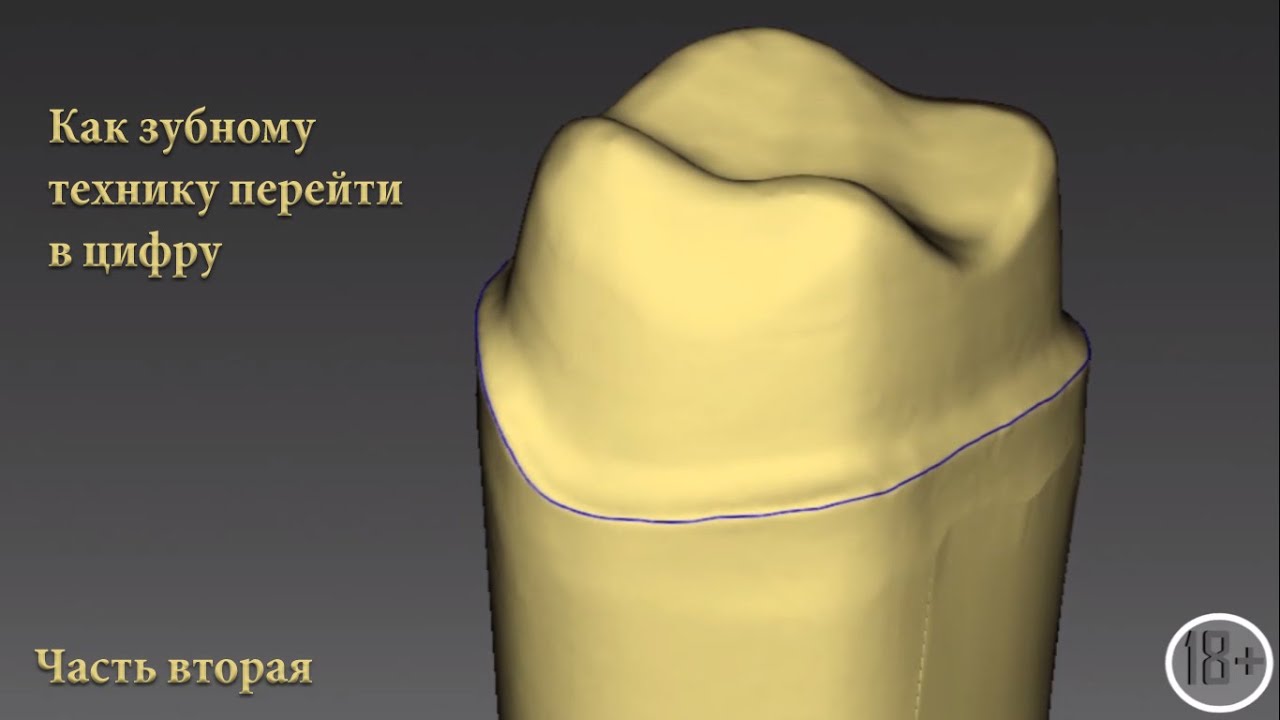 Цифровые технологии для зубных техников. Часть вторая
