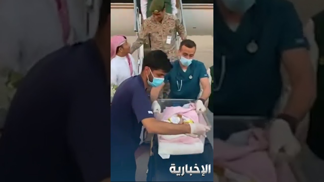 وصول التوأم السيامي اليمني مودة ورحمة إلى الرياض