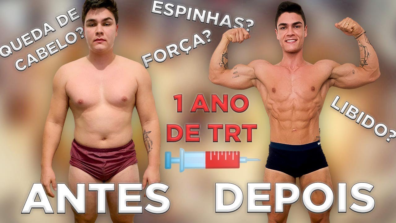 UM ANO USANDO TESTOSTERONA - O QUE MUDOU?