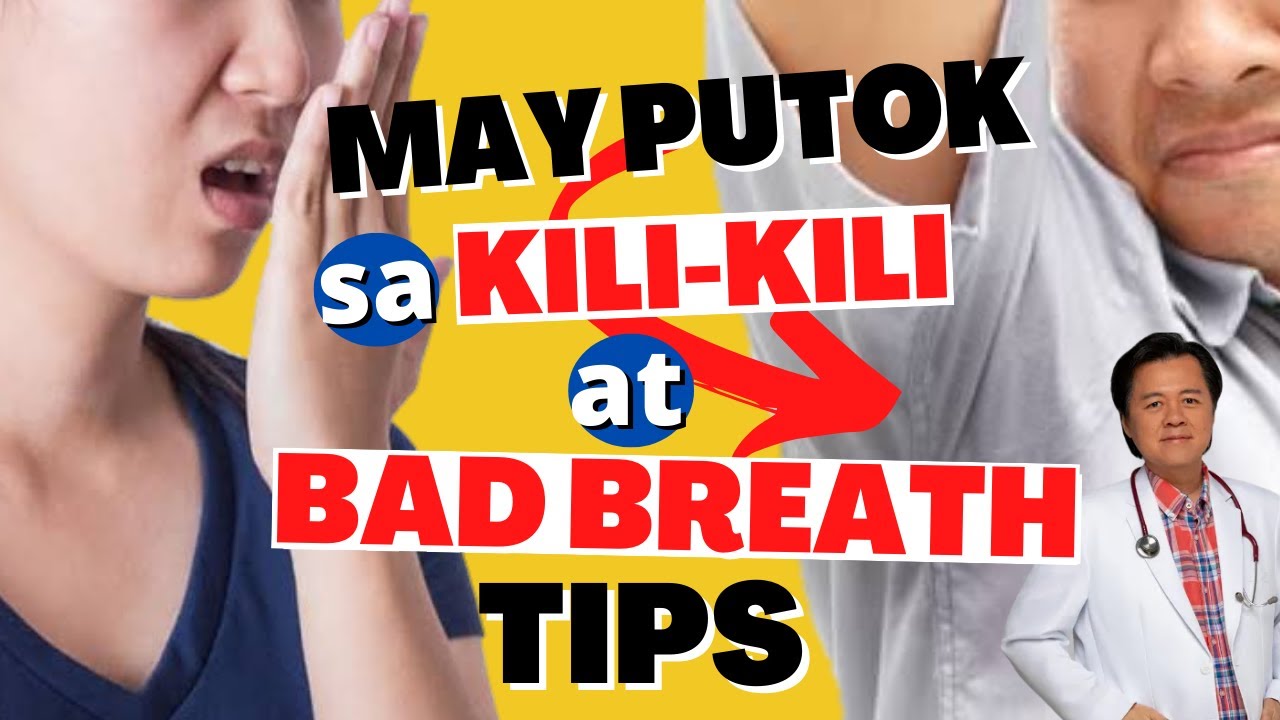 May Putok sa Kili-Kili at Bad Breath Tips - By Doc Willie Ong (Internist ang Cardiologist)