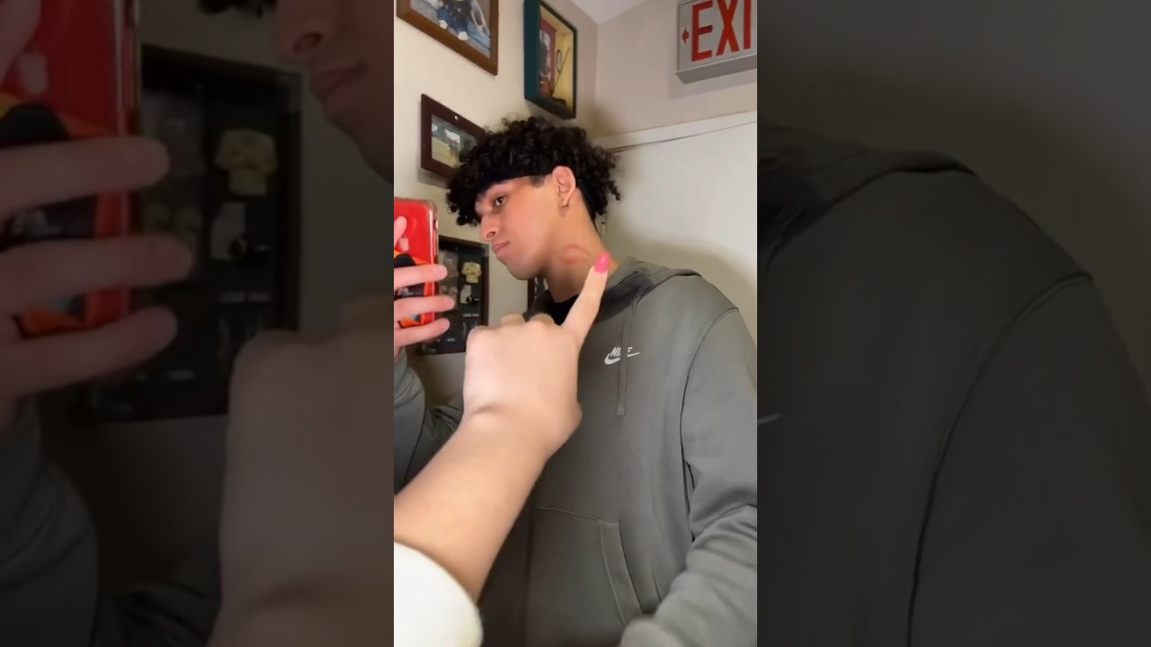 Hickey prank on my boyfriend *GONE WRONG* 