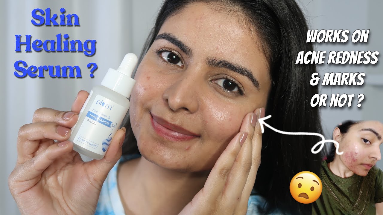 Plum 10% Niacinamide Serum Review | Suitable for Oily Acne skin ? Kashika
