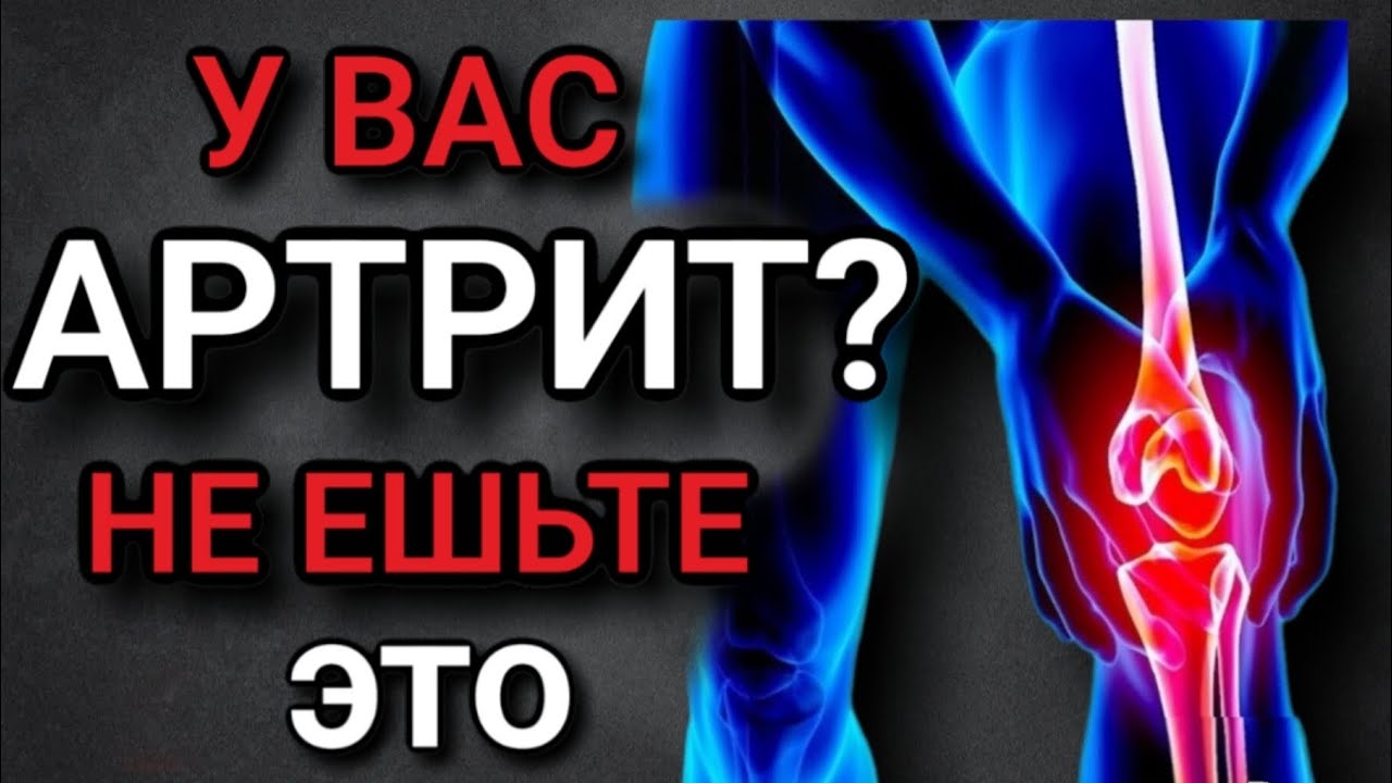 Не ешьте это ( 8 продуктов) , если у вас АРТРИТ