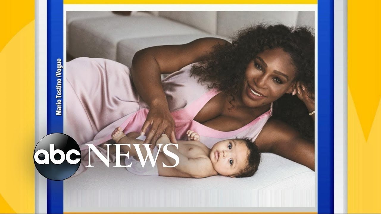 Serena Williams opens up about medical scare after giving birth to baby girl