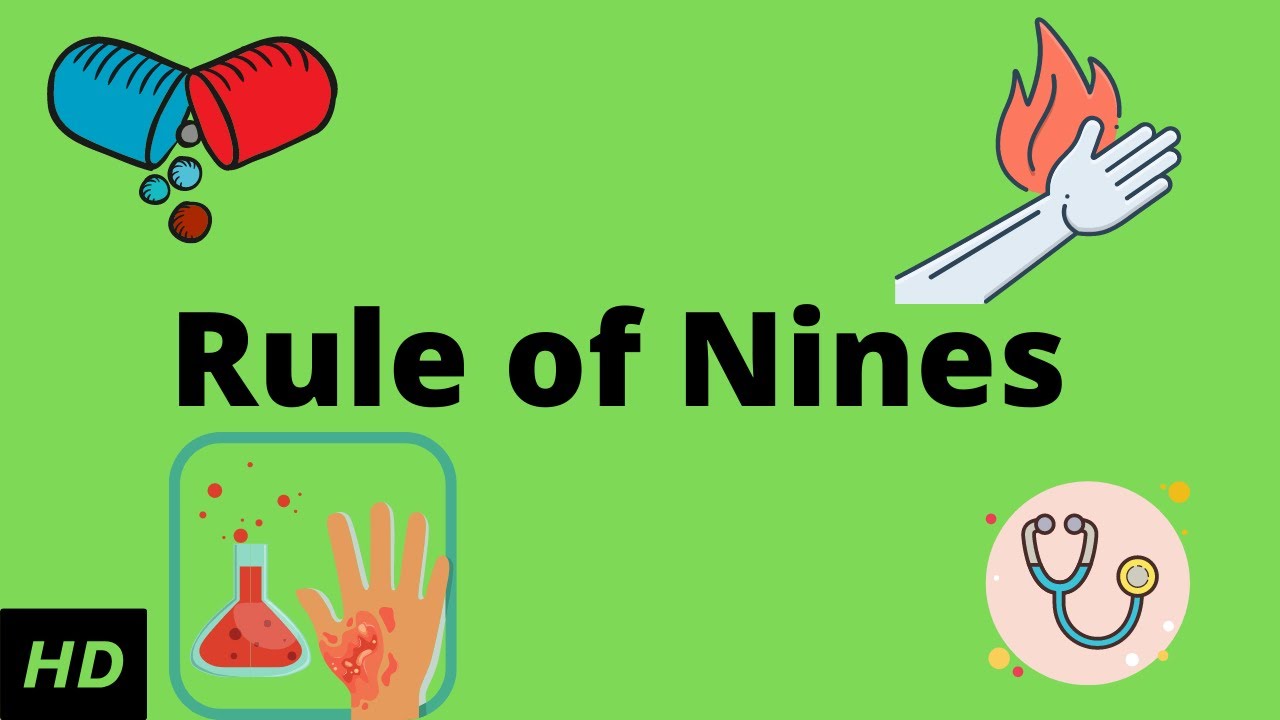 What is Wallace rule of nines?