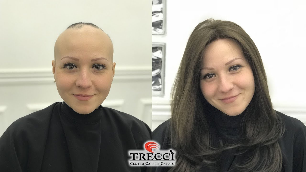 Come risolvere alopecia, Parrucca capelli naturali