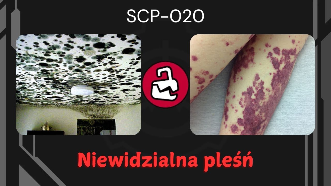 SCP-020 | Niewidzialna pleśń |