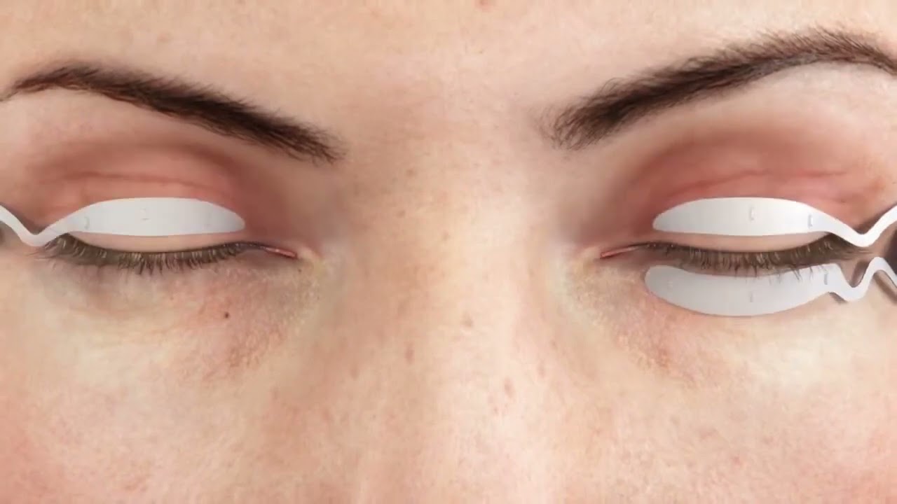 TearCare System for MGD & Dry Eye Relief