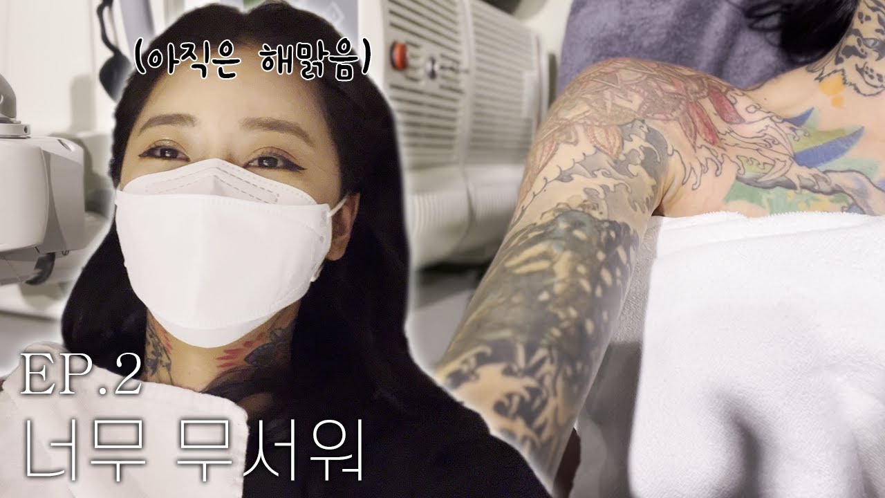 새로운 문신을 위한 '문신 제거 시술 2회차' (유료광고X)