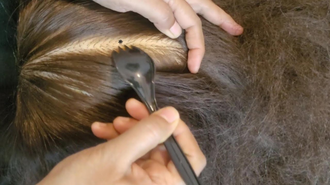 The Most Satisfying Scalp Check & Scratching ASMR✨