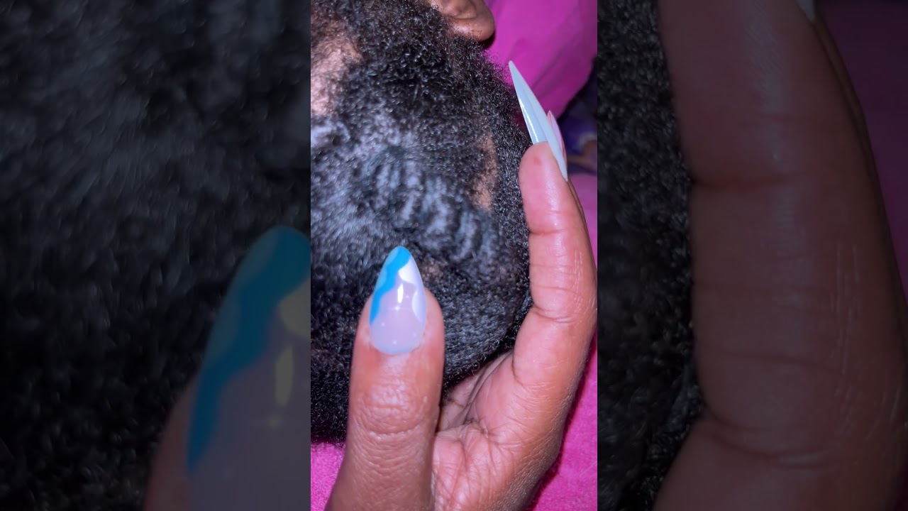 ASMR Scalp Scratching and Soft Gum Chewing Sounds  #asmr #mouthwhisper #asmrmouthsounds #asmrsounds 