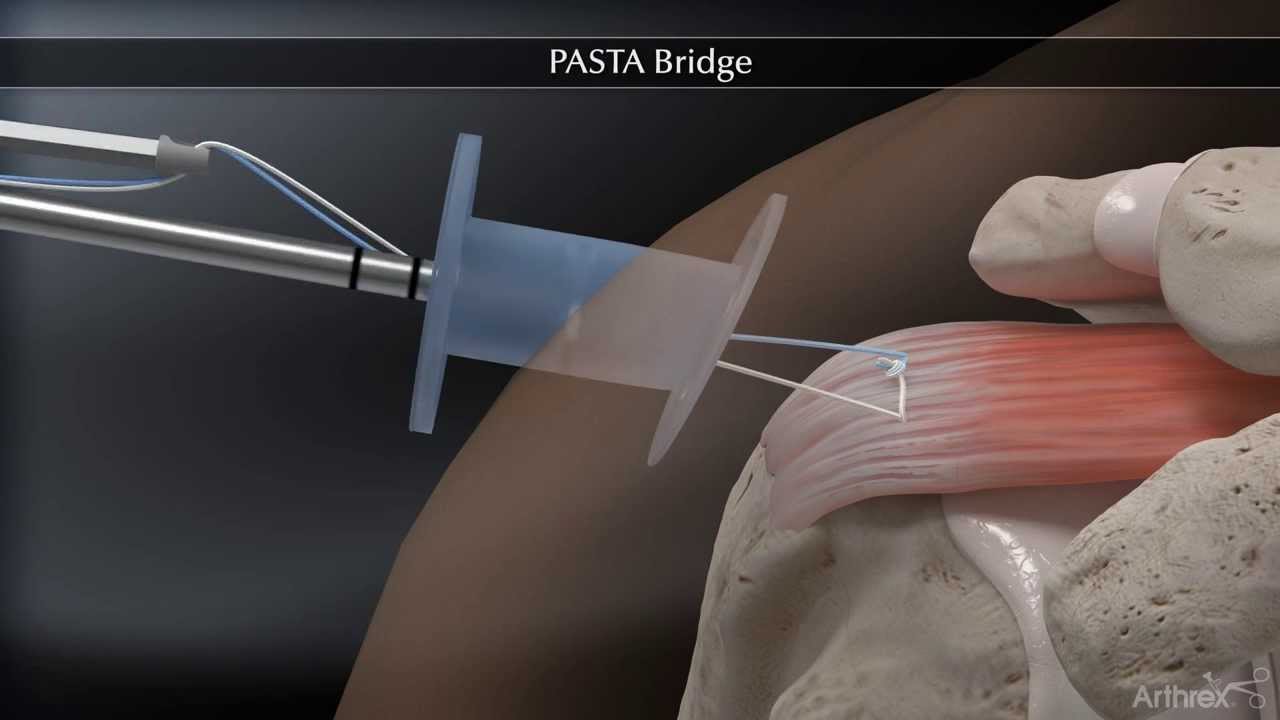 PASTA Bridge Animation