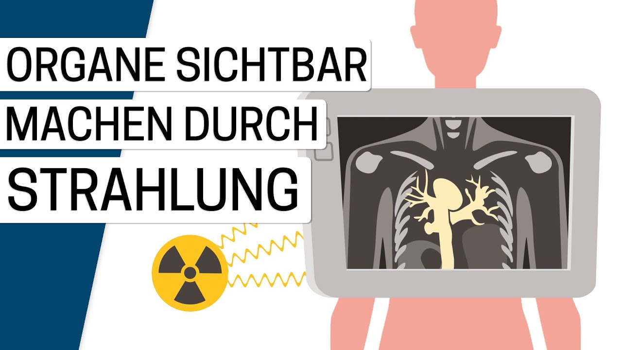Wie funktioniert eine Computertomografie (CT)?