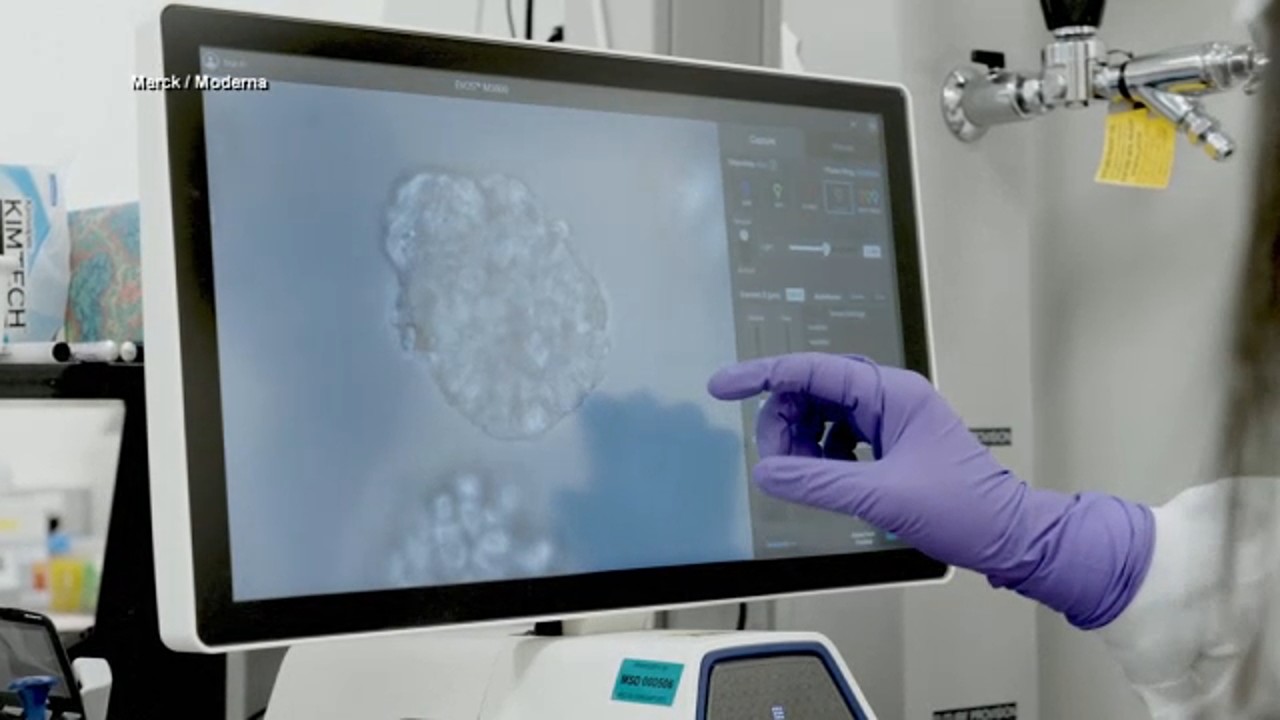 Merck and Moderna mRNA-based cancer vaccine shows promise