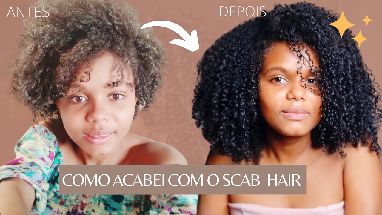 O QUE &Eacute; SCAB HAIR E O QUE EU FIZ PRA ACABAR | CABELO CRESPO