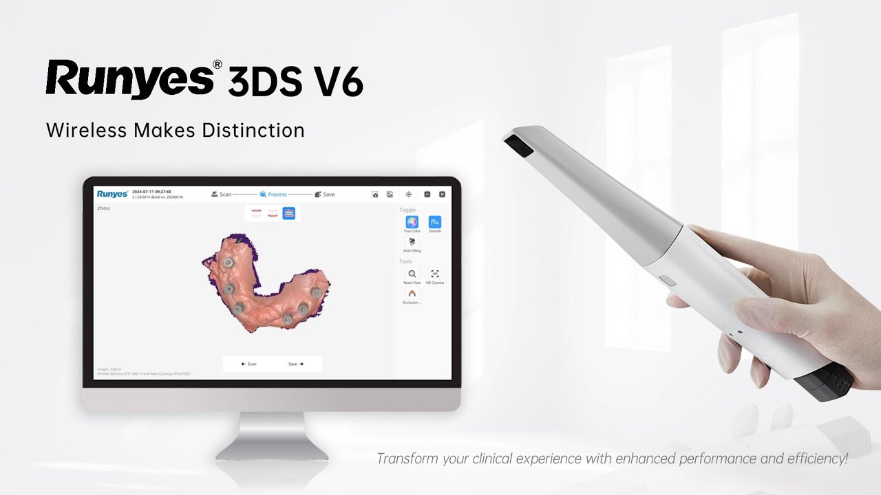 Unboxing Runyes 3DS V6 Intraoral Scanner: Wireless Makes Distinction