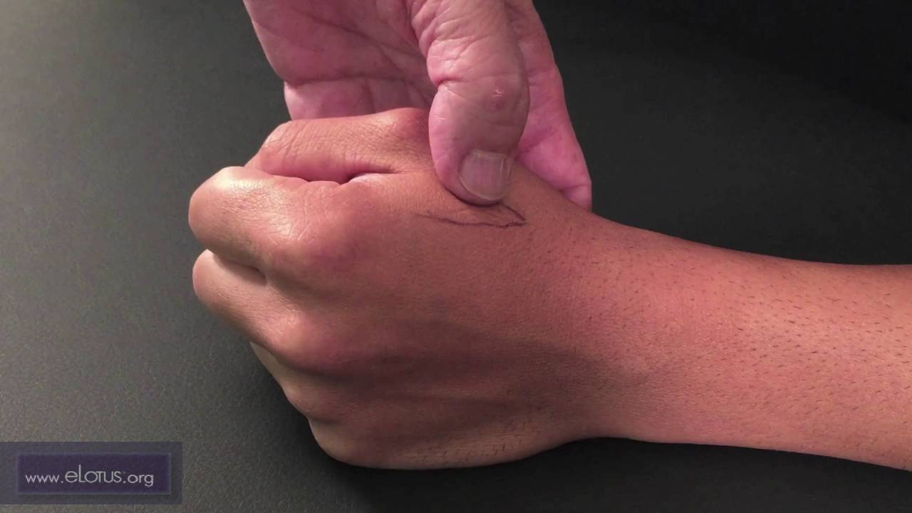 Dabai (T 22.04), Linggu (T 22.05) [DEUTSCHE]: Master Tung Punkte