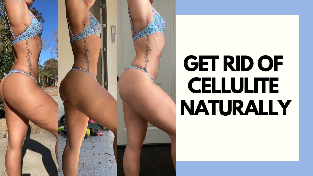 GET RID OF CELLULITE-THIS WORKS!! | HOME WORKOUT + TIPS FOR REDUCING CELLULITE